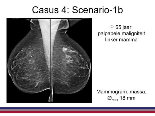 Help, een UBO - NKI / AvL