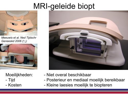 Help, een UBO - NKI / AvL