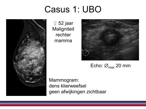 Help, een UBO - NKI / AvL