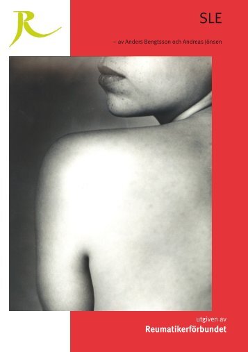 Sjukdomsbroschyr SLE - Reumatikerförbundet