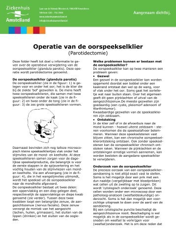 Oorspeekselklier operatie (parotidectomie) - Ziekenhuis Amstelland