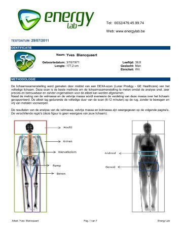 Bekijk hier het resultaat van mijn DXA bodyscan - Yves Blancquaert