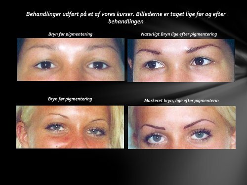 Billeder permanent make-up før og efter.pdf - City Wellness