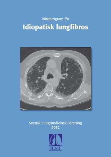 Idiopatisk lungfibros - Svensk Lungmedicinsk Förening