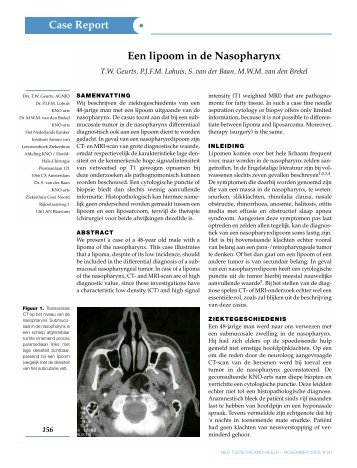 Een lipoom in de Nasopharynx Case Report - Facial Plastic Surgery