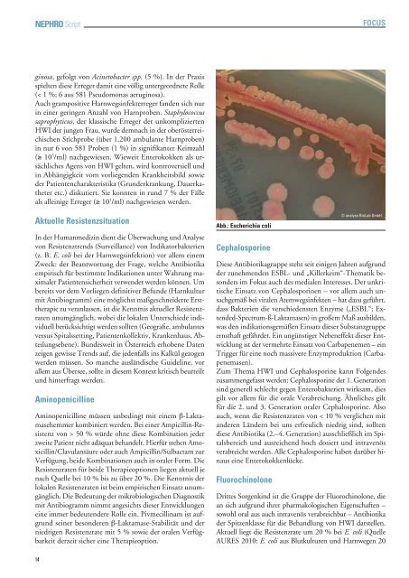 02/2012 - Harnwegsinfektionen - Was ist Nephrologie?