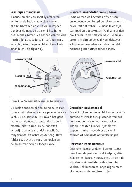 verwijderen van neus- en/of keelamandelen bij kinderen - Olvg