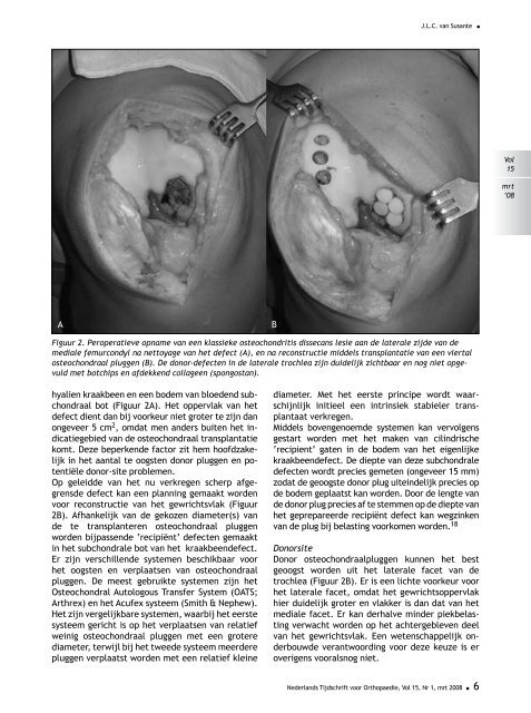 ONederlands Tijdschrift voor - Nederlands Tijdschrift voor Orthopaedie