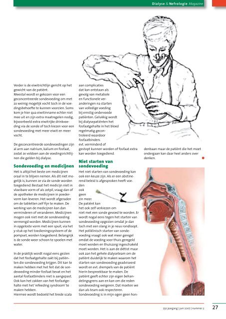 15-06-2007 V&VN Dialyse en Nefrologie magazine 2 2007