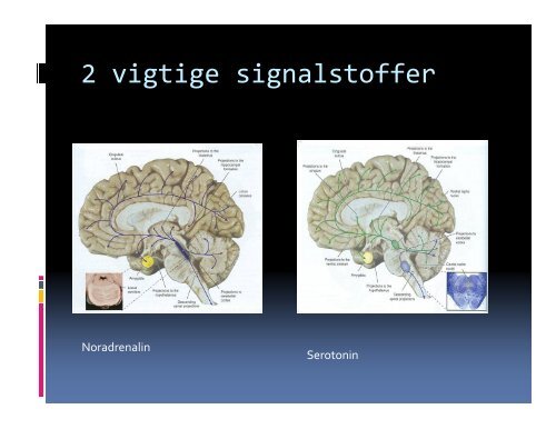 Elsebet Steno Hansen,overlæge,ph.d,Psykiatrien V ordingborg