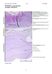 Ventrikel - corpus/fundus oversigt - PAS farvet - paintedlady dot org