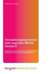 Verzakkingsoperaties met vaginale MESH (matjes) [104kb] - Tergooi