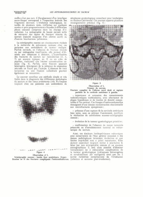Les ostéoradionécroses du sacrum, Rhumatologie, 1988
