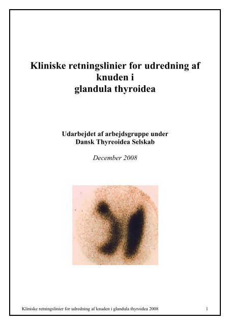 Kliniske retningslinier for udredning af knuden i glandula thyroidea