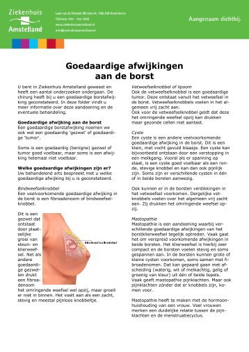 3005 Goedaardige afwijkingen aan de borst - Ziekenhuis Amstelland