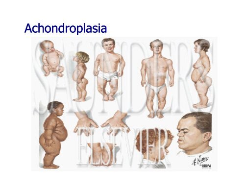 Congenital Abnormalities/Deformities of the Lower Limb