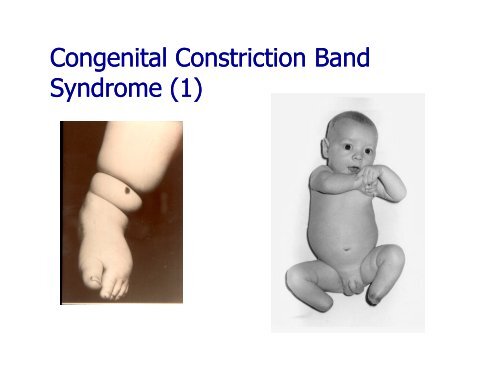 Congenital
