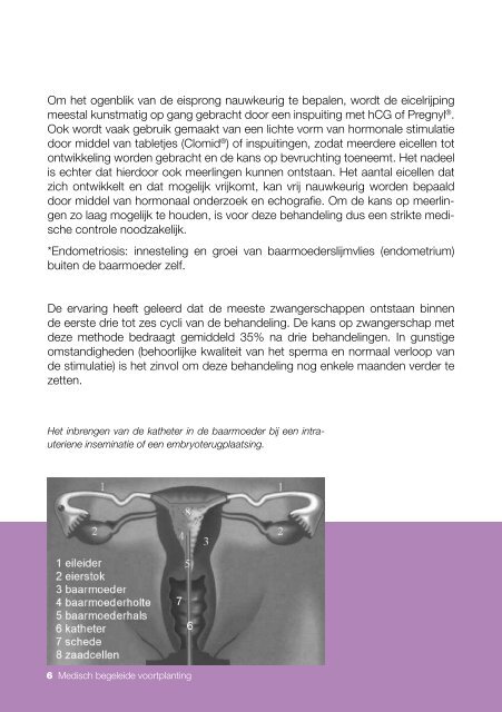 Medisch begeleide voortplanting - UZ Gent