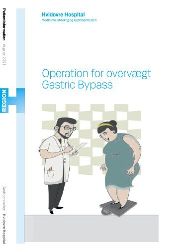 Operation for overvægt Gastric Bypass