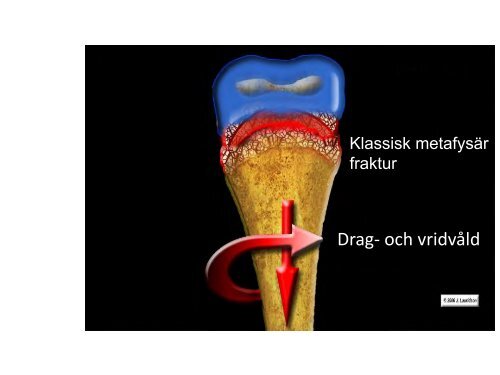 Barn som far illa.pdf - Orust kommun