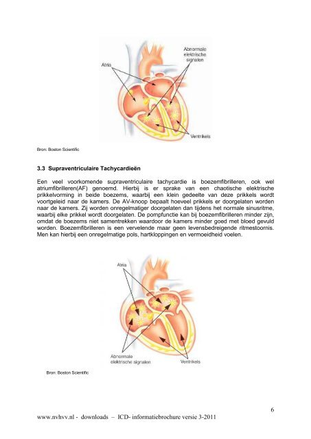 1 www.nvhvv.nl - downloads – ICD- informatiebrochure versie 3-2011