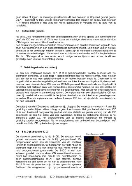 1 www.nvhvv.nl - downloads – ICD- informatiebrochure versie 3-2011