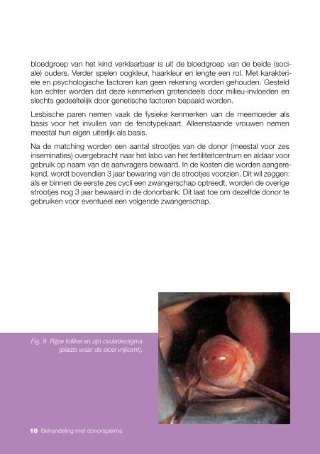 Behandeling met donorsperma - UZ Gent