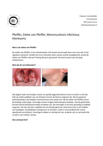 Pfeiffer, Ziekte van Pfeiffer, Mononucleosis Infectiosa, Klierkoorts