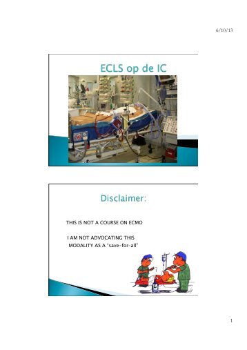 Extracorporal life-support (ECLS) op de intensive care