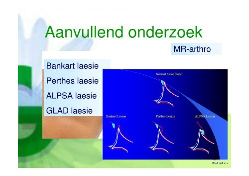 Presentatie mrt 2011 - Instabiliteit - Groene Hart Ziekenhuis