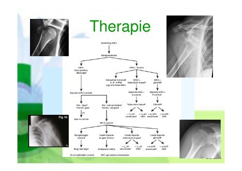 Presentatie mrt 2011 - Instabiliteit - Groene Hart Ziekenhuis