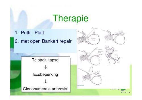 Presentatie mrt 2011 - Instabiliteit - Groene Hart Ziekenhuis