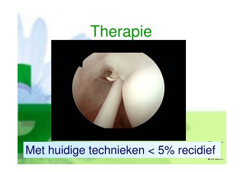 Presentatie mrt 2011 - Instabiliteit - Groene Hart Ziekenhuis