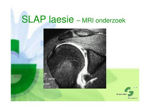 Presentatie mrt 2011 - Instabiliteit - Groene Hart Ziekenhuis