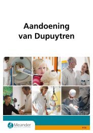 Aandoening van Dupuytren - Meander Medisch Centrum