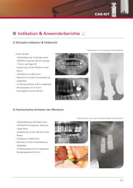 CAS-KIT - Osstem.