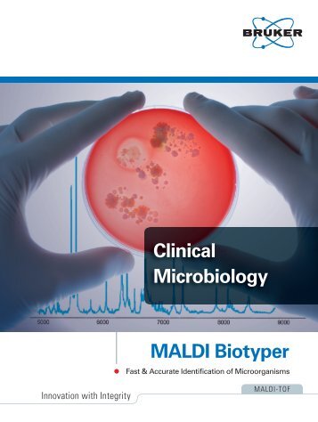 The MALDI Biotyper System - Bruker Daltonics