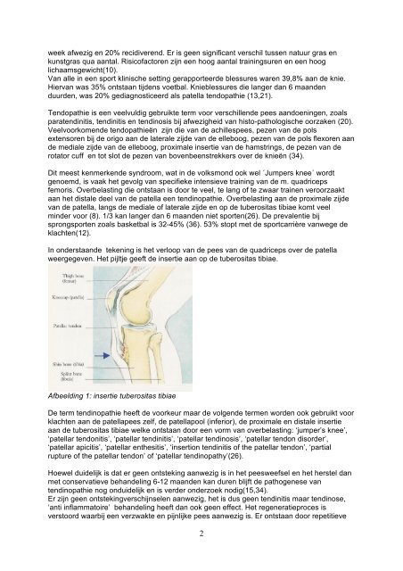 Excentrische training bij insertie tendinopathie patellapees