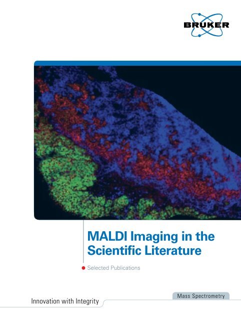 Selected MALDI Imaging Publications - Bruker Daltonics