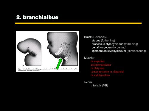 BRANCHIALAPPARATET