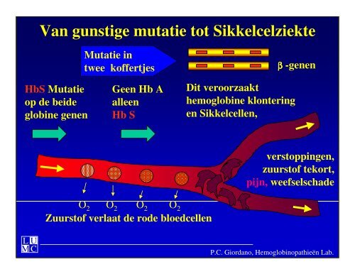 αα ββ Wat is Sikkelcelziekte ? - Erfocentrum