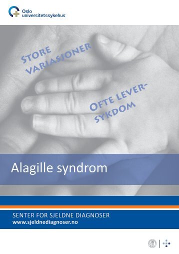 Alagille syndrom (pdf) - Senter for sjeldne diagnoser