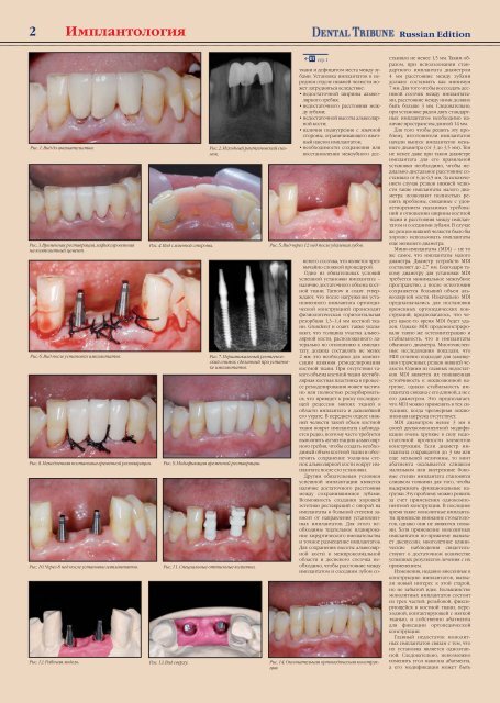 PDF 4 MB - Consilium Medicum