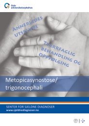 Metopicasynostose/ trigonocephali - Senter for sjeldne diagnoser