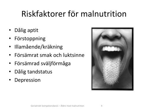 Äldre med malnutrition