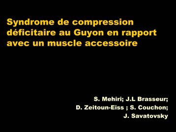 Syndrome de compression déficitaire au Guyon en rapport avec un ...