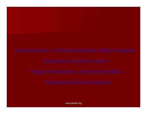 (Microsoft PowerPoint - Sikora - Kr\352gozmyk ... - Pandm