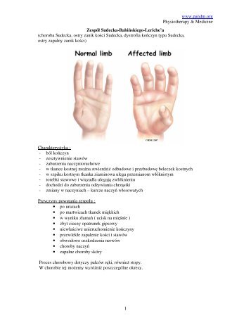 Zespol Sudecka.pdf - Pandm