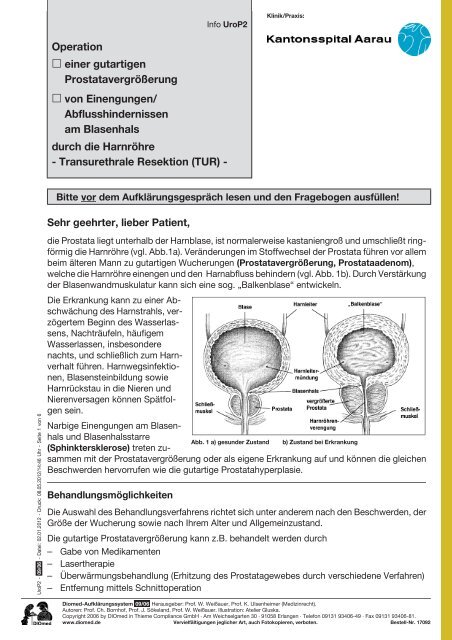 Abflusshindernissen Am Blasenhals Durch Die Harnrohr