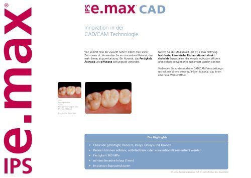 IPS e.max CAD – für die CAD/CAM-Technologie - Ivoclar Vivadent